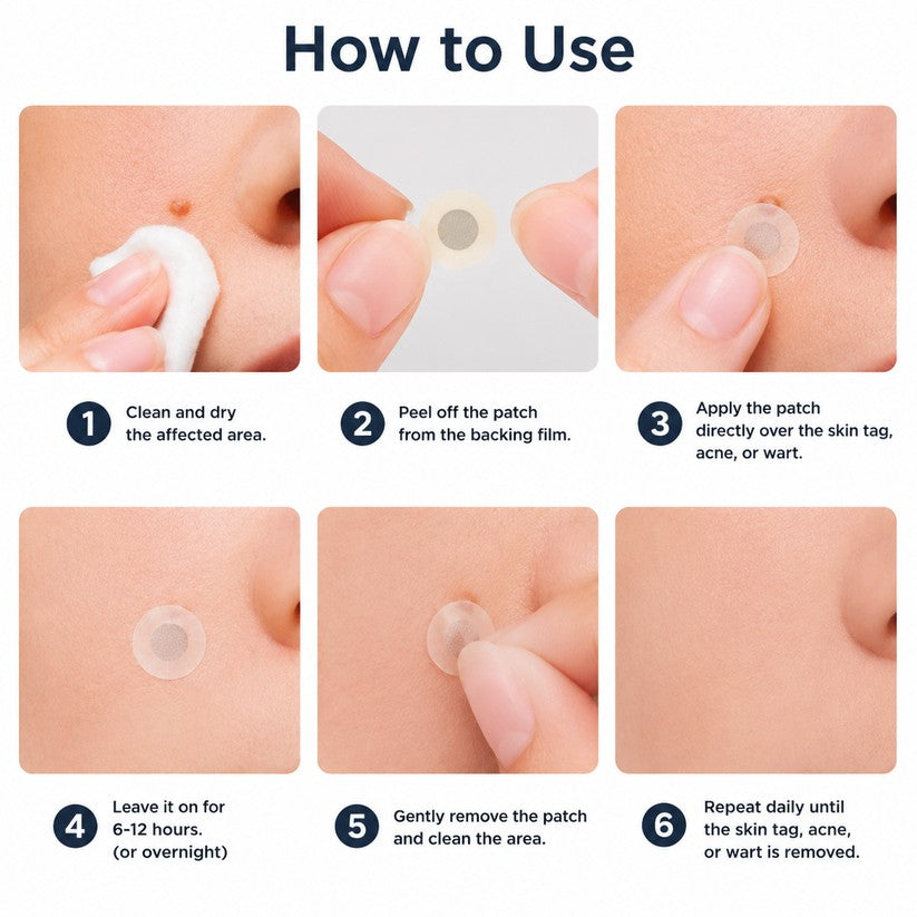 👩‍⚕️GFOUK® 2-in-1 Microneedle & Hydrocolloid Patch🍀 | Removes raised moles, acne, flat warts, and skin tags | Helps improve wrinkles, scars, and blemishes | Invisible patches for face and body.