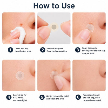 👩‍⚕️GFOUK® 2-in-1 Microneedle & Hydrocolloid Patch🍀 | Removes raised moles, acne, flat warts, and skin tags | Helps improve wrinkles, scars, and blemishes | Invisible patches for face and body.