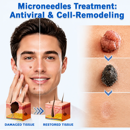 👩‍⚕️GFOUK® 2-in-1 Microneedle & Hydrocolloid Patch🍀 | Removes raised moles, acne, flat warts, and skin tags | Helps improve wrinkles, scars, and blemishes | Invisible patches for face and body.