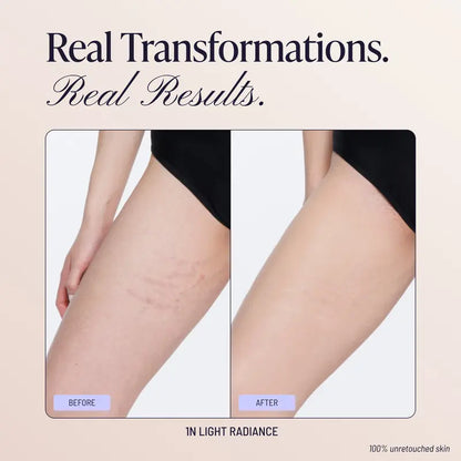 🏆 Top Rated! 80K+ SOLD! ⚡ -Westmore Beauty Body Coverage Perfector