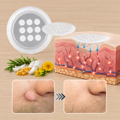 👩‍⚕️GFOUK® 2-in-1 Microneedle & Hydrocolloid Patch🍀 | Removes raised moles, acne, flat warts, and skin tags | Helps improve wrinkles, scars, and blemishes | Invisible patches for face and body.